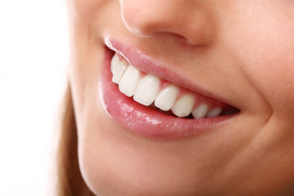 causes of teeth discoloration and whitening solutions